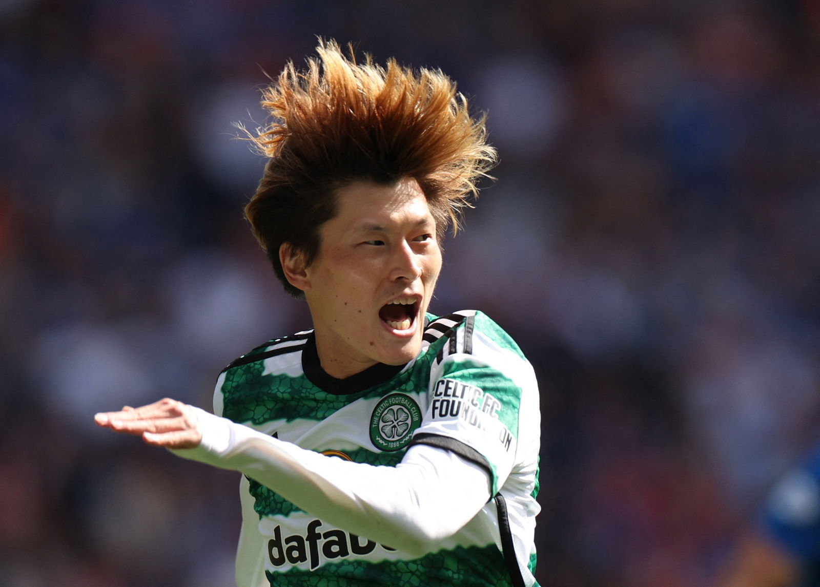 Scottish Premiership: Kyogo injured in Celtic win, Rangers see off