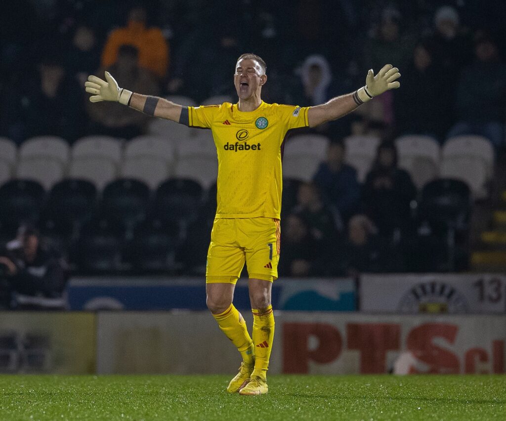 Joe Hart