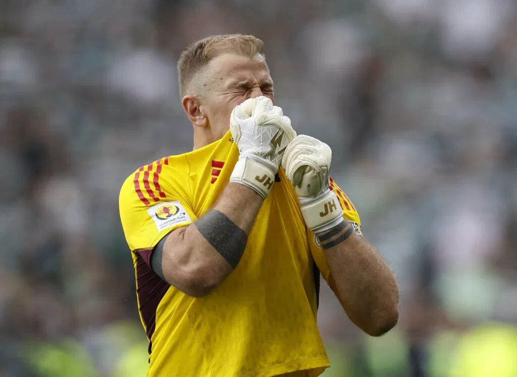 Joe Hart Celtic