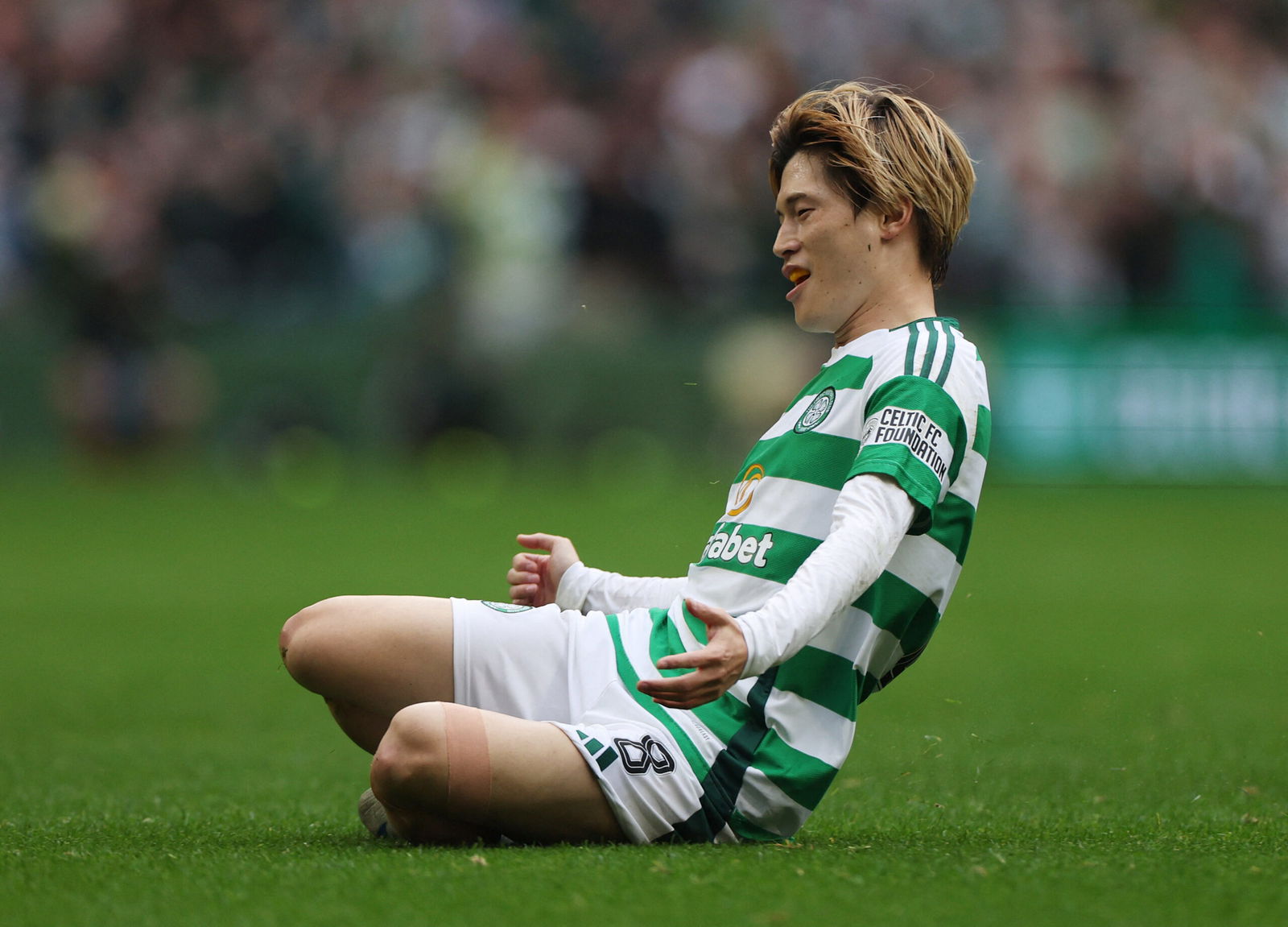 Watch: Kyogo Hilariously Describes Derby Goal | Latest Celtic News