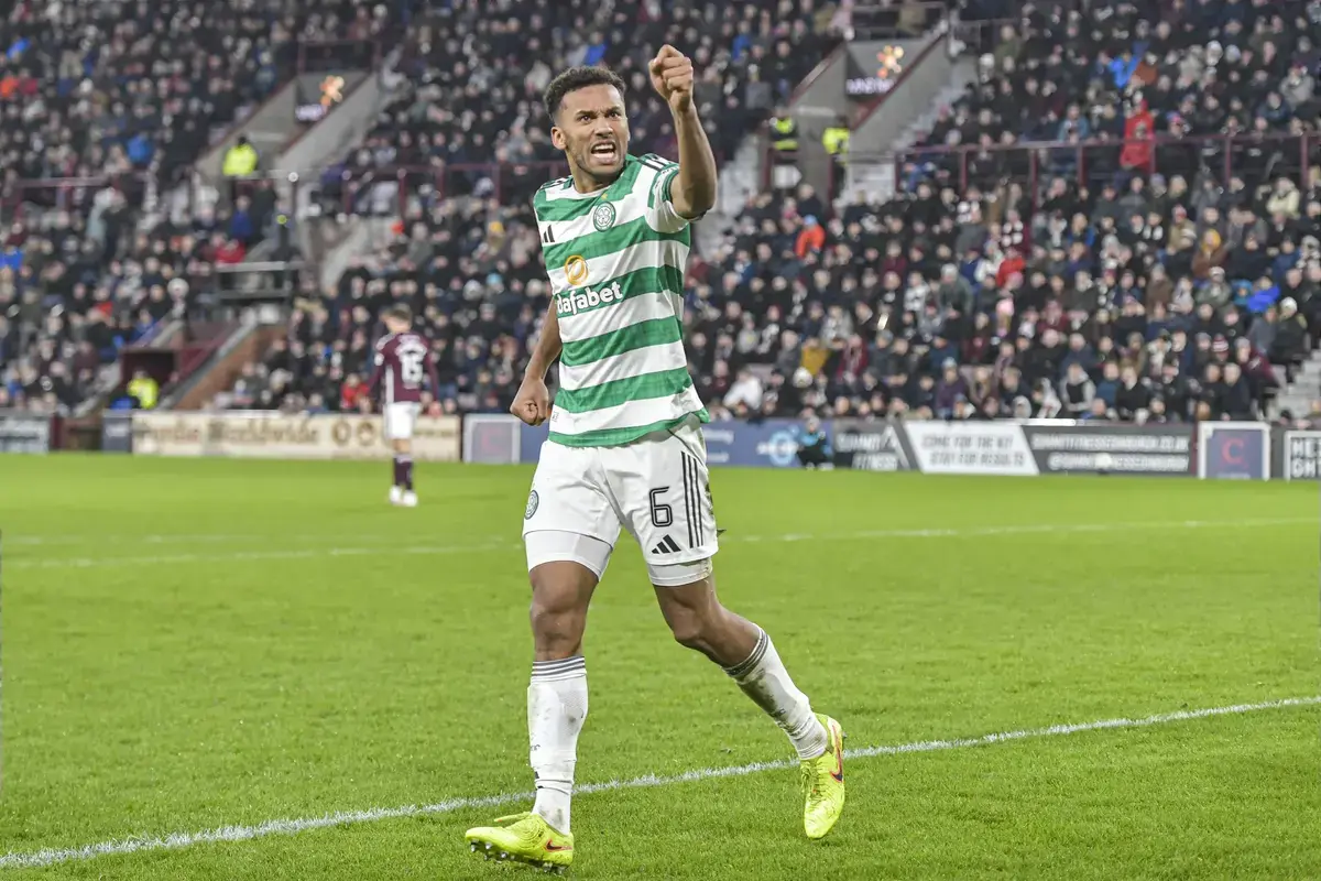 Auston Trusty Delivers Celtic Injury Update