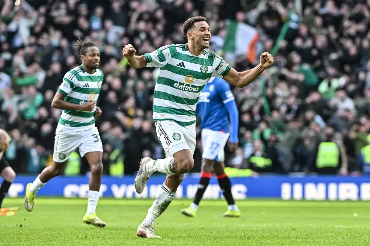 Celtic Star Has World Cup Claim Made Despite Injury Scare